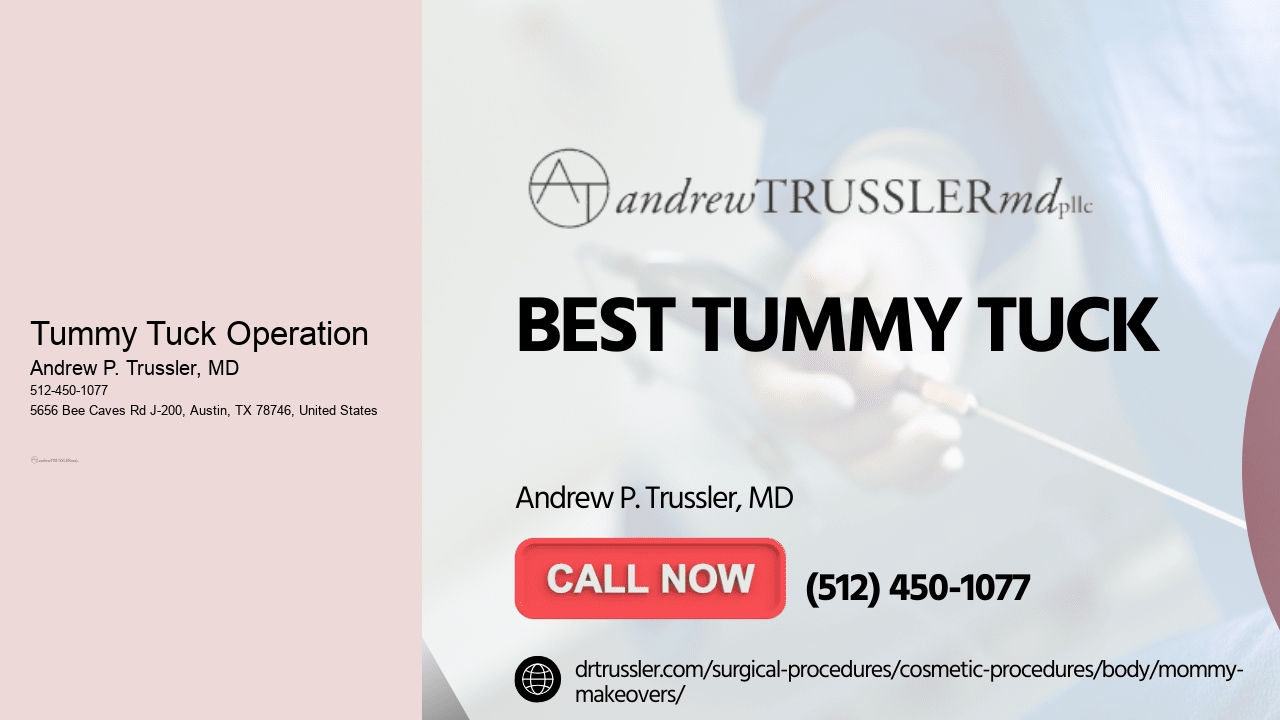 Tummy Tuck Operation